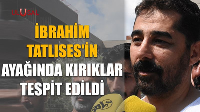 İbrahim Tatlıses'in ayağında kırıklar tespit edildi